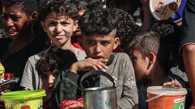 استشهاد 30 طفلًا في غزة بسبب سوء التغذية