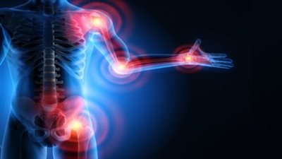 في اليوم العالمي للتوعية من التهاب المفاصل.. اكتشف أعراضه وطرق الوقاية