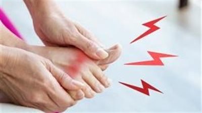 النقرس لم يعد حكرًا على الأثرياء.. دراسة تكشف سر مرض الملوك