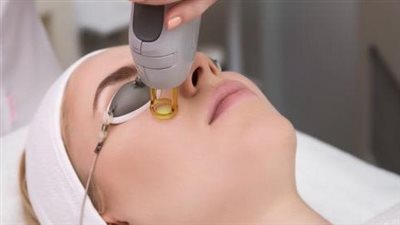 حروق الليزر: أسباب غير متوقعة وعلاجات موثوقة