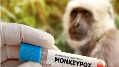 «جدري القرود» أبرز التفاصيل بعد تسجيل أول حالة في أمريكا.. الأعراض والتشخيص