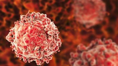 أعراض وأسباب سرطان الدم وأفضل طرق العلاج 