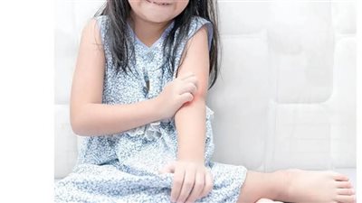 إذا كان طفلك مصابًا بالصدفية.. أفضل نظام غذائي لتخفيف الأعراض وطرق الوقاية