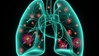 طرق فعالة للوقاية من الالتهاب الرئوي وحماية جهازك التنفسي