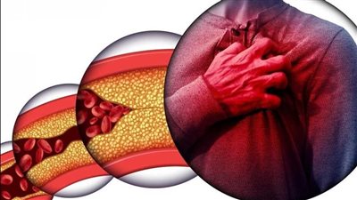 تجنب هذه الأخطاء.. نصائح فعالة للحفاظ على مستوى الكوليسترول في الدم