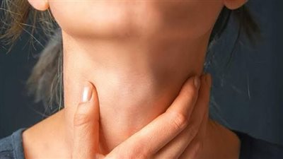 تورم الرقبة علامة تحذيرية لمشكلة صحية خطيرة.. إليك الأعراض