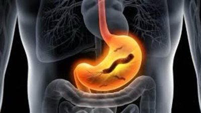 جفاف الفم وطعم معدني.. أعراض تكشف إصابتك بجرثومة المعدة