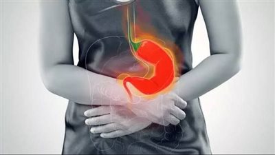 ابدأ يومك براحة.. نصائح فعالة للتخلص من الحموضة صباحًا