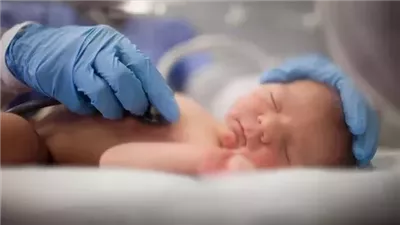  بين الأسطورة والطب.. لحظة ولادة لا تُنسى لطفل داخل كيسه الأمنيوسي