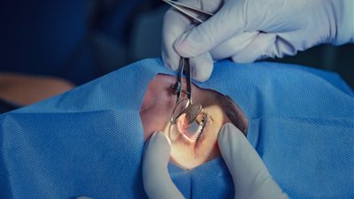 شرحوا الجثمان فوق قبرها.. تفاصيل مثيرة بشأن واقعة سرقة عيون متوفاة بالجيزة