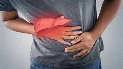 الكبد الدهني.. خطر صامت قد يؤدي إلى التليف وهذه أبرز علاماته وأسبابه