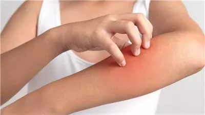 طرق فعالة لتفادي الطفح الجلدي في الصيف.. احمِ بشرتك من حرارة الشمس