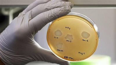 منظمة الصحة تحذر.. البكتيريا المقاومة للمضادات تهدد النظام الطبي بالكامل