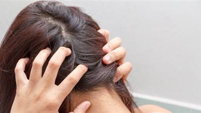 حرقة فروة الرأس ليست عرضا عابرا.. علامات خفية على مشكلات صحية أعمق 