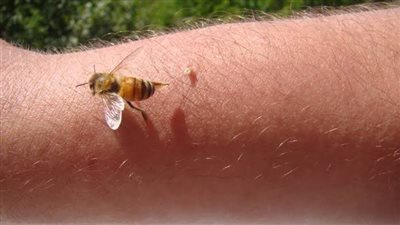 متى تتحول «لدغات الحشرات» إلى خطر صحي؟.. إشارات لا يجب تجاهلها