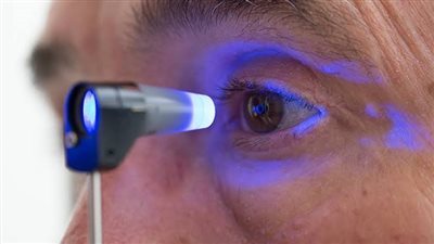 «أمل جديد لمرضى الجلوكوما».. دعامة دقيقة تزرع داخل العين لحماية البصر 