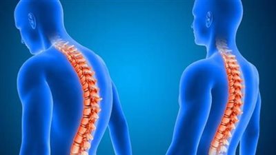 «تحدب الظهر».. الأسباب الخفية والمضاعفات الخطيرة وطرق العلاج الفعالة