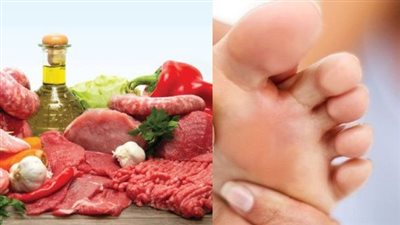 مش بس اللحوم الحمراء.. أطعمة ومشروبات مفاجئة تؤدي إلى «النقرس»