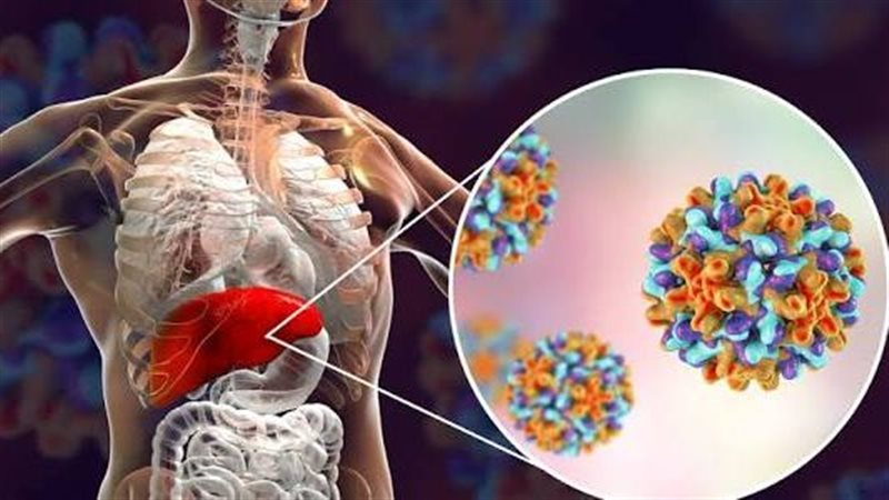 فيروس الكبد الوبائي