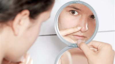 علامة غامضة تكشف إصابة امرأة بمرض «سرطان الأنف»