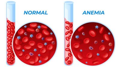 طعام مذهل يحارب الأنيميا والكوليسترول ويقوي عضلات الجسم