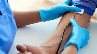 داء ترسب الأصبغة الدموية.. مرض يرتبط بزيادة الحديد