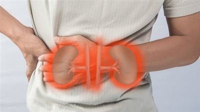 عوامل خفية تسبب حصوات الكلى بعيدا عن نقص الماء