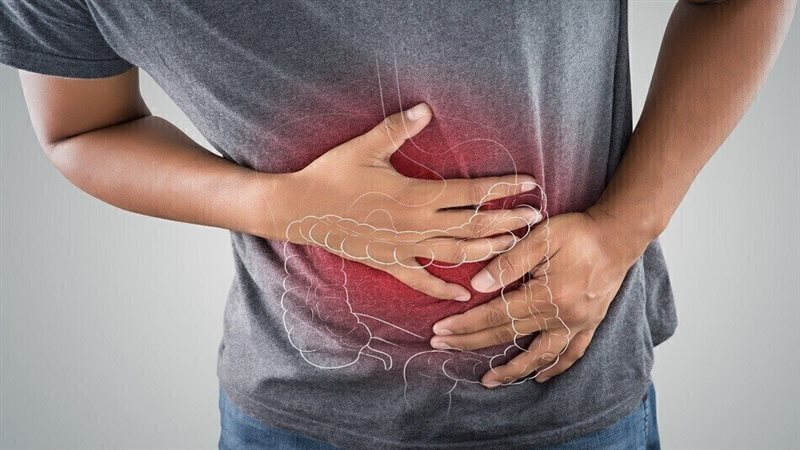 حرقة المعدة 